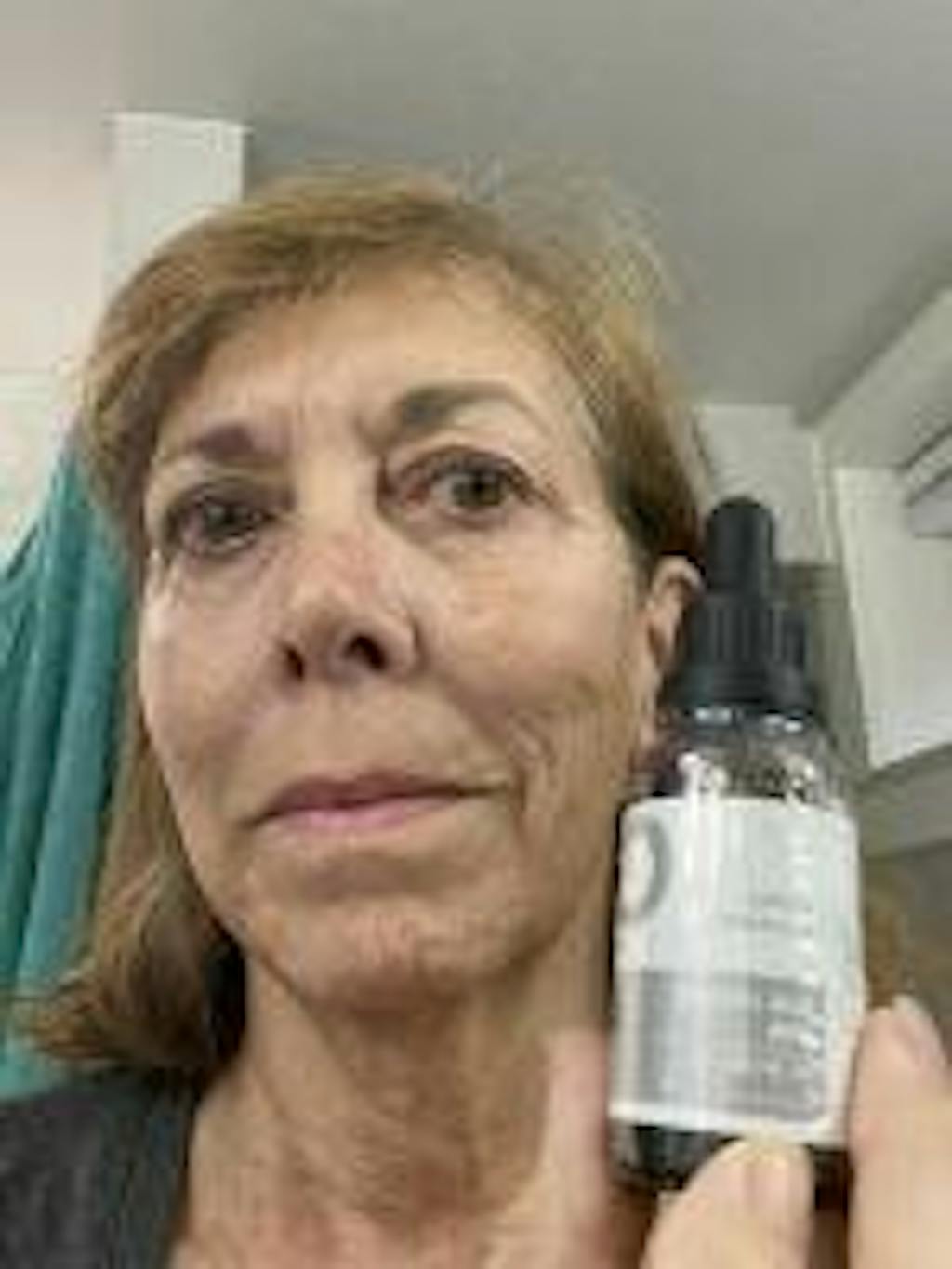 Glycolic Acid Peel Open Formula