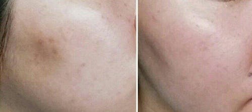 Shirojyun Brightening Lotion (170ml)