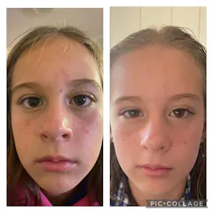 Review picture