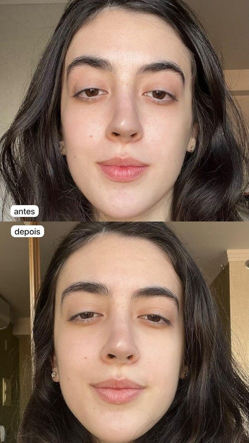 Solução S-Control | Sérum Corretor de Acne