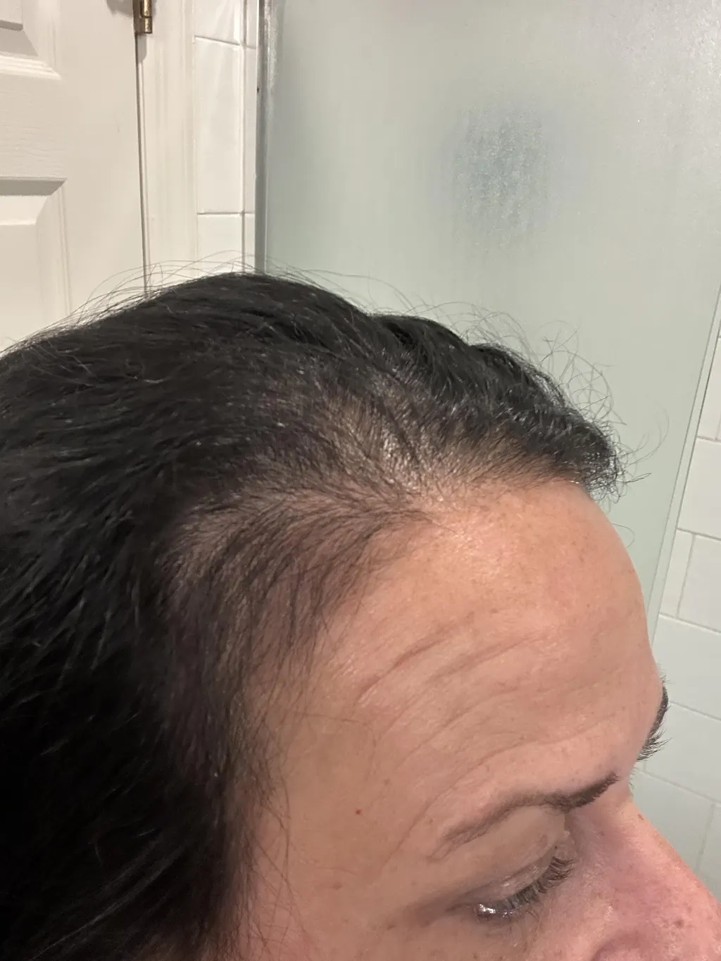 Copper Peptides for Hair Serum | GHK-Cu for Hair