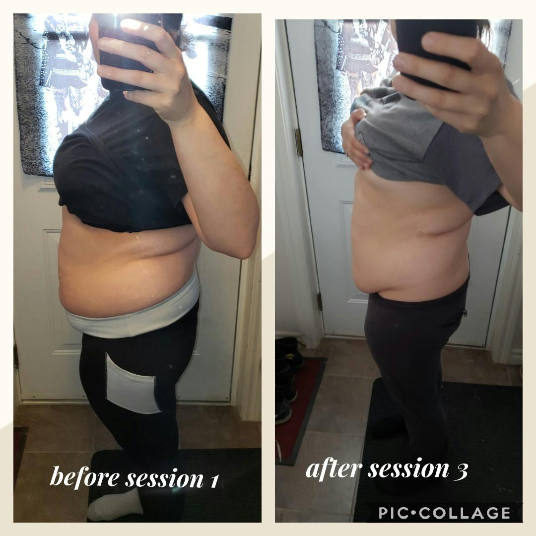 ultrasonic slimming review