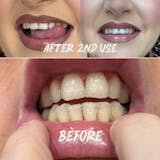 28 PAP Teeth Whitening Strips