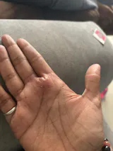 Psori Ease Body & Scalp Oil