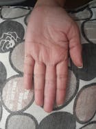 Kit Dermatitis o Resequedad corporal y manos