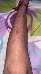Kit Dermatitis o Resequedad corporal y manos