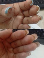 Kit Dermatitis o Resequedad corporal y manos