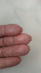 Kit Dermatitis o Resequedad corporal y manos