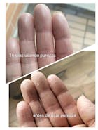 Kit Dermatitis o Resequedad corporal y manos