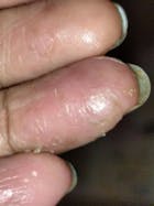 Kit Dermatitis o Resequedad corporal y manos