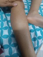 Kit Dermatitis o Resequedad corporal y manos