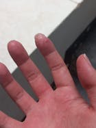 Kit Dermatitis o Resequedad corporal y manos