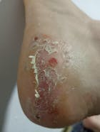 Kit Dermatitis o Resequedad corporal y manos