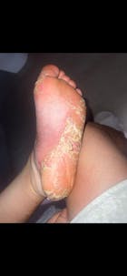 Kit Dermatitis o Resequedad corporal y manos