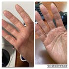 Kit Facial Dermatitis o Resequedad