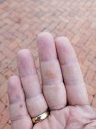 Kit Dermatitis o Resequedad corporal y manos