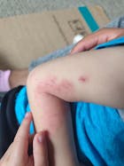 Kit Dermatitis o Resequedad corporal y manos