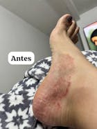 Kit para dermatitis y resequedad corporal