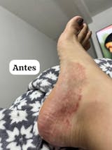 Kit para dermatitis y resequedad corporal