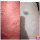 Kit Confort Corporal