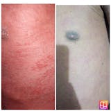 Kit Confort Corporal