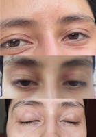 Kit para dermatitis y resequedad corporal