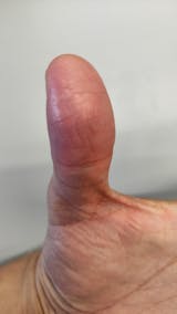 Kit para dermatitis y resequedad corporal