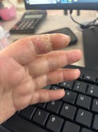 Kit para dermatitis y resequedad corporal