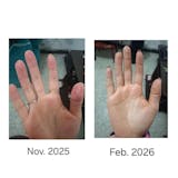 Kit para dermatitis y resequedad corporal