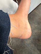 Kit para dermatitis y resequedad corporal