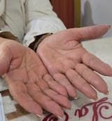 Kit para dermatitis y resequedad corporal