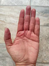 Kit para dermatitis y resequedad corporal