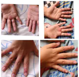 Kit para dermatitis y resequedad corporal