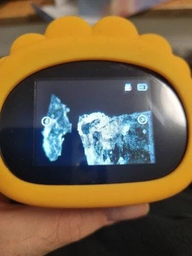 Customer photo for 1000X Digital Microscope for Kids — Micro Explorer