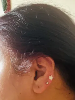 Review picture