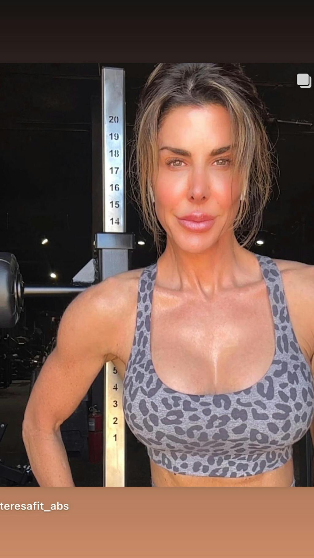 Galvanic Water Peeler Gold Plus+ AntiAging Skin Revival Handset