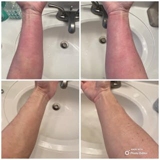 Ultimate Red Light Therapy Device