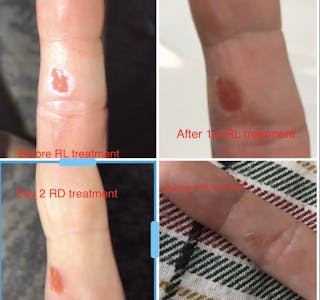 Full-Body Red Light Therapy Device