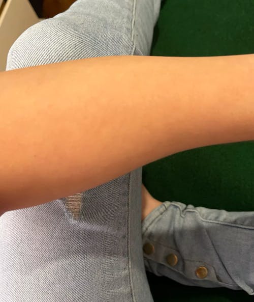 Removely IPL 3+   (inkl. Summer Sale Geschenk)