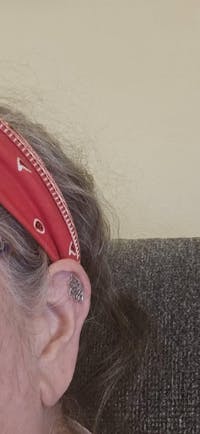 Lotus Flower Hidden Helix