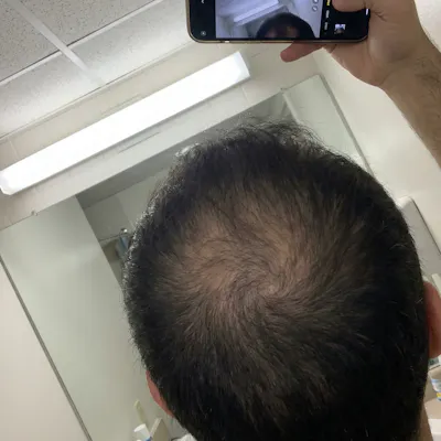 Before