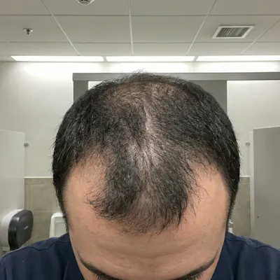 Before