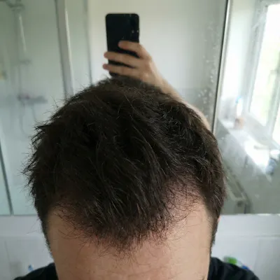 After