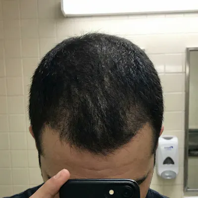 After