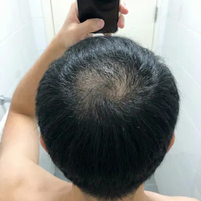 After