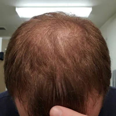 After