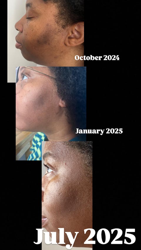 CLARIFYING C12 SERUM | FREE SHIPPING ON FIRST ORDER| FREE SHIPPING ON ORDERS OVER £30