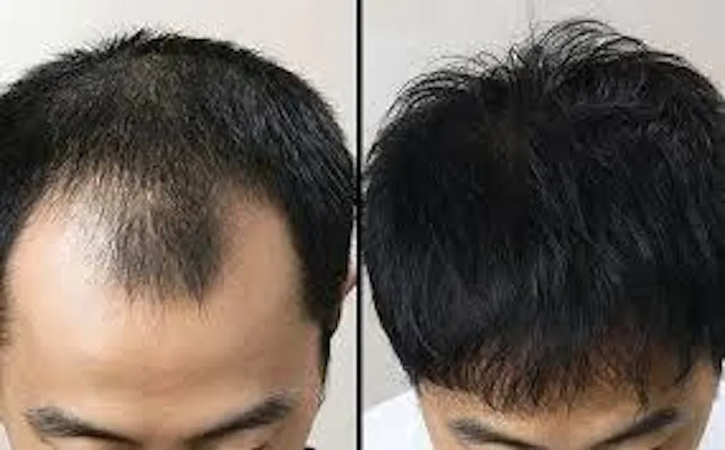 Growth Hair Oil - For Faster Hair Growth, Reduced Hair Fall, Scalp Nourishment, and Damage Repair