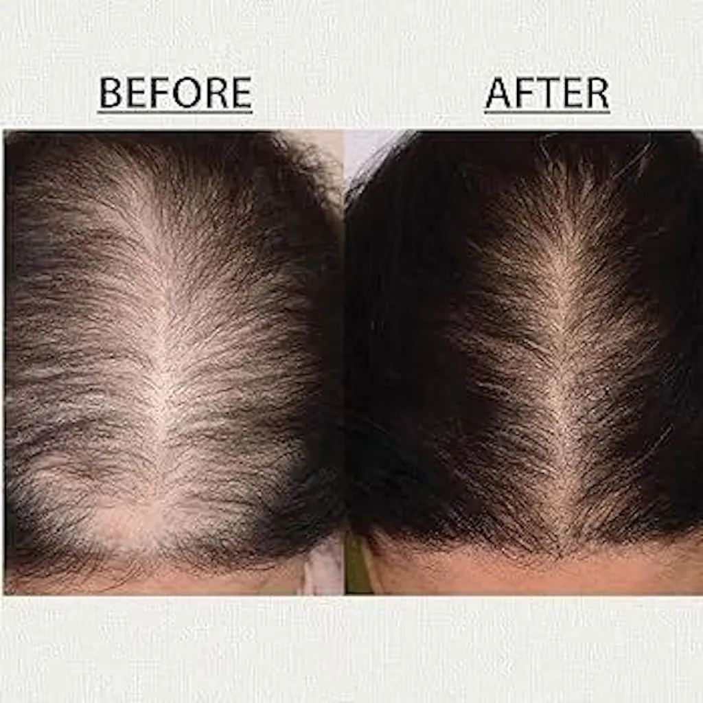 Almond Oil Wood Pressed – 100% Pure Cold Pressed - Deeply Nourishes Skin & Hair, Rich in Vitamin E & Antioxidants, Chemical-Free, Lightweight & Non-Greasy