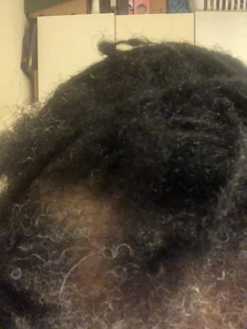 Alopecia + Thinning Hair Solutions - The Harvest Hair Growth Kit